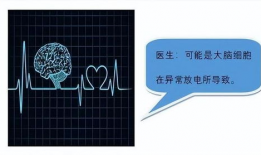 视频脑电图能检查出什么,揭示大脑活动的秘密